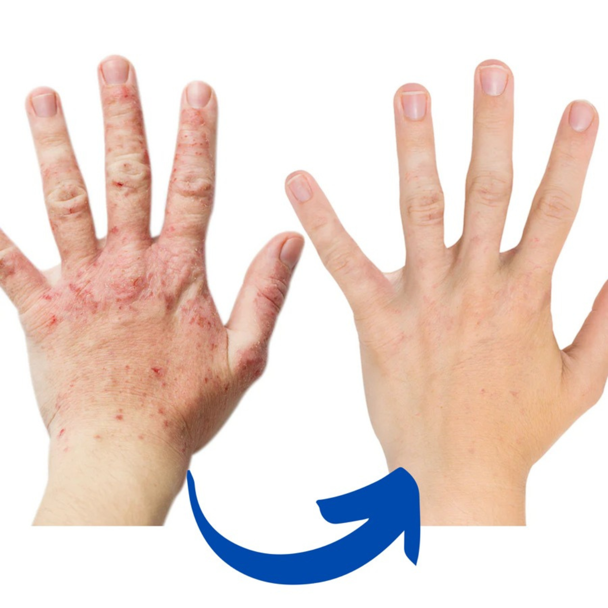 B&B Near Infrared Hand Therapy Gloves