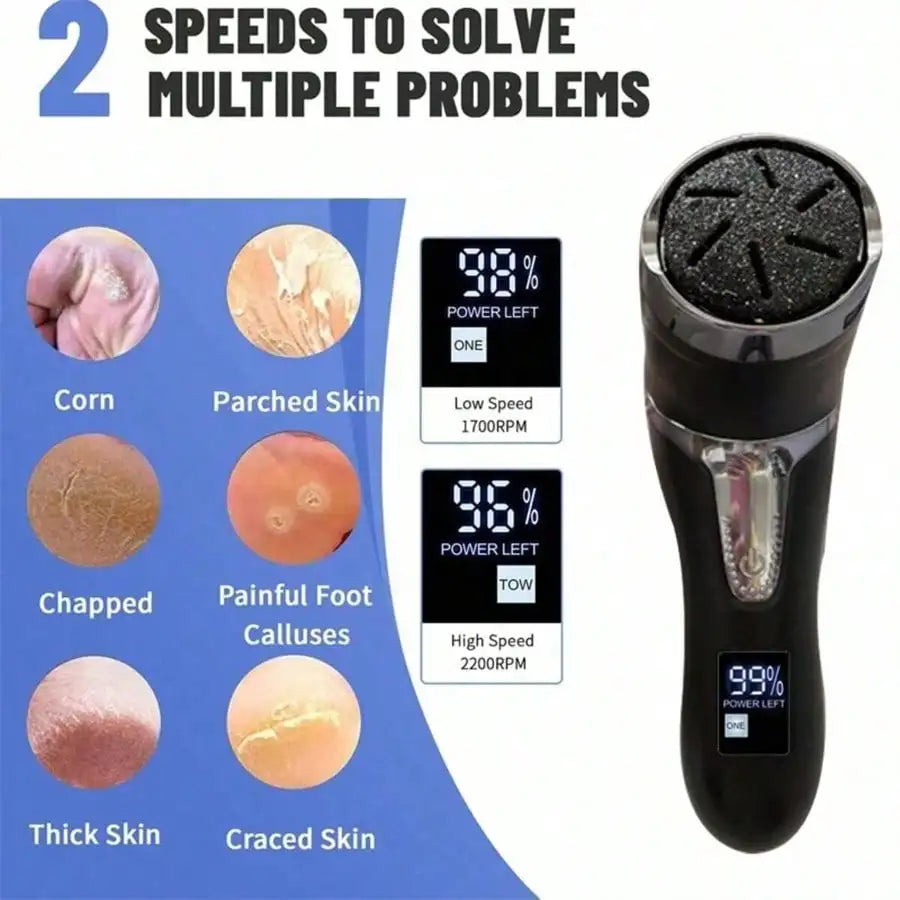 B&B Electric Foot File Callus Remover — Smooth, Comfortable Feet at Home