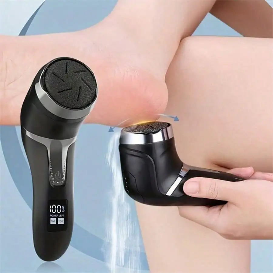 B&B Electric Foot File Callus Remover — Smooth, Comfortable Feet at Home